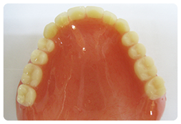 保険適用レジン床デンチャー